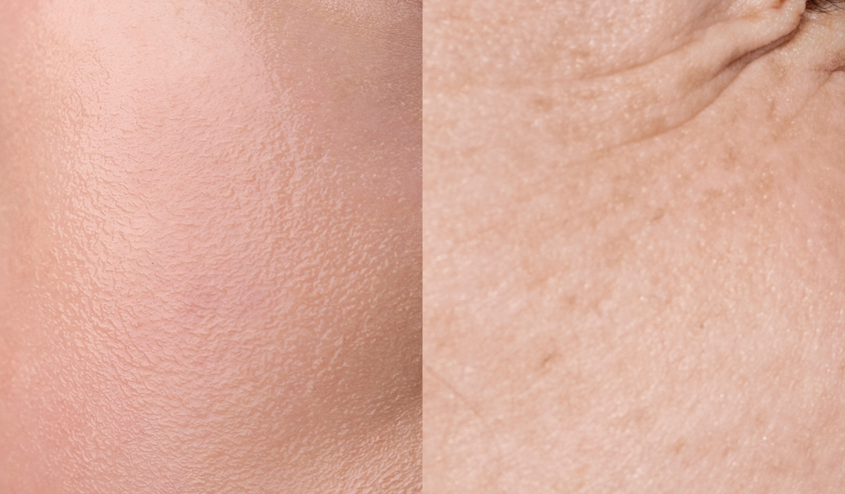 Illustration du vieillissement cutané